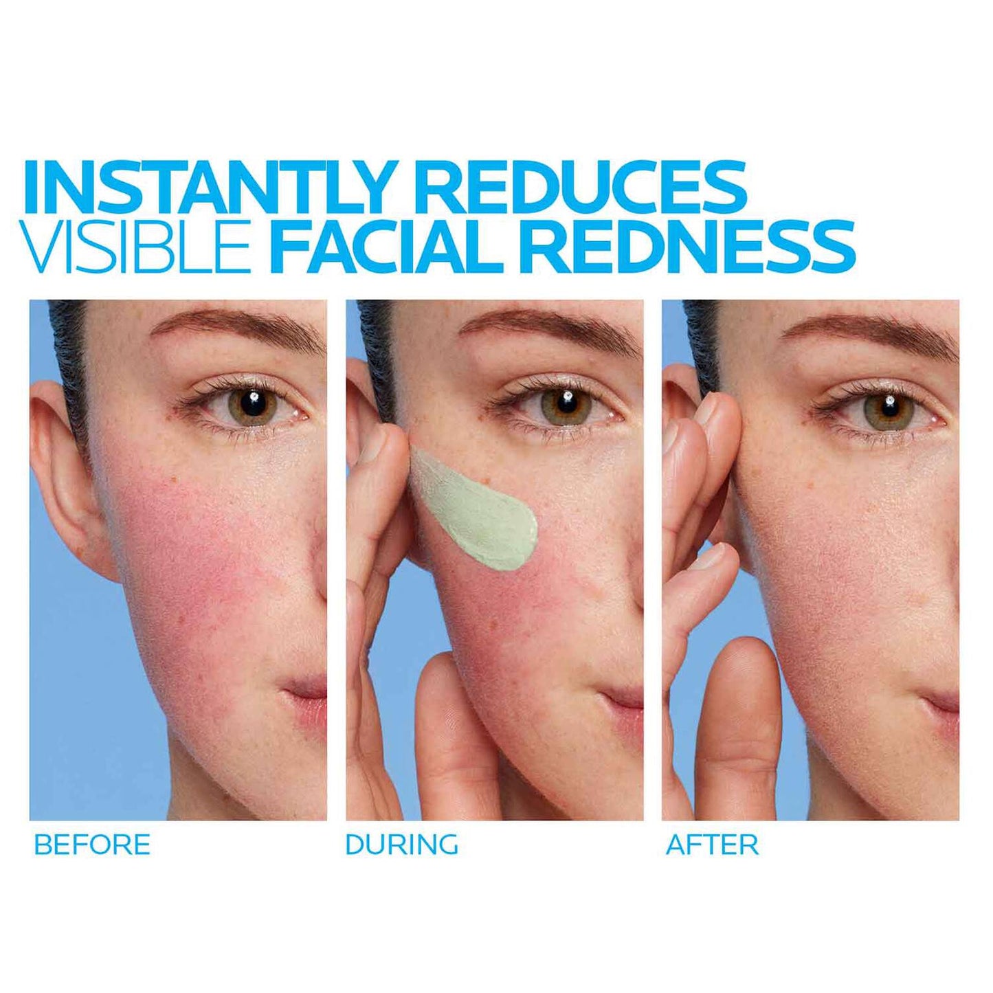 toleriane-rosaliac-ar-face-cream-for-visible-redness-w7 8_Toleriane_Rosaliac-AR-before-after.jpg