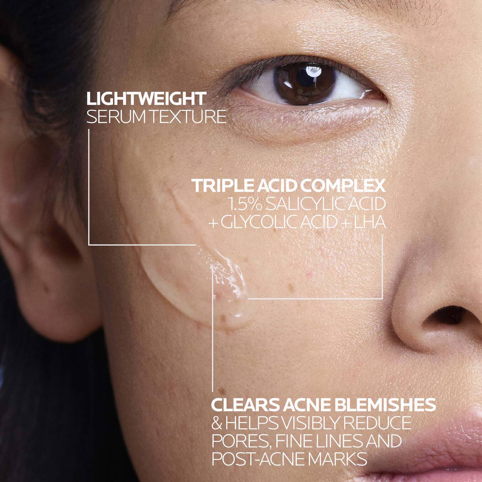 effaclar-salicylic-acid-acne-treatment-serum-g5 LaRochePosay-Product-Effaclar-Effaclar-Serum-30ml-3337875722827-Texture-REV.jpg