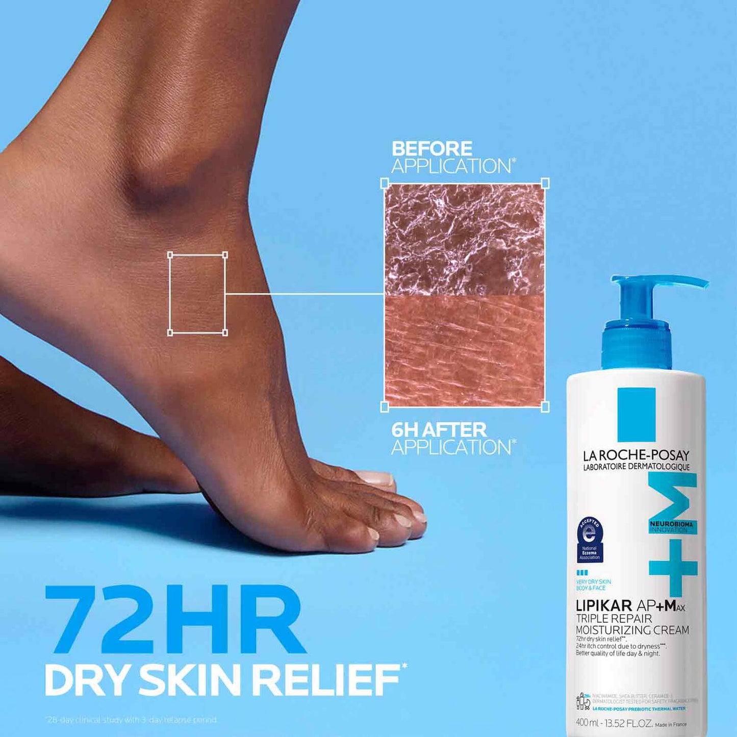 lipikar-ap-max-triple-repair-moisturizing-cream-m5 LaRochePosay-Product-Skincare-Lipikar-Balm-AP+MAX-400ml-3337875941150-ATF-PIM-BeforeAfter.jpg