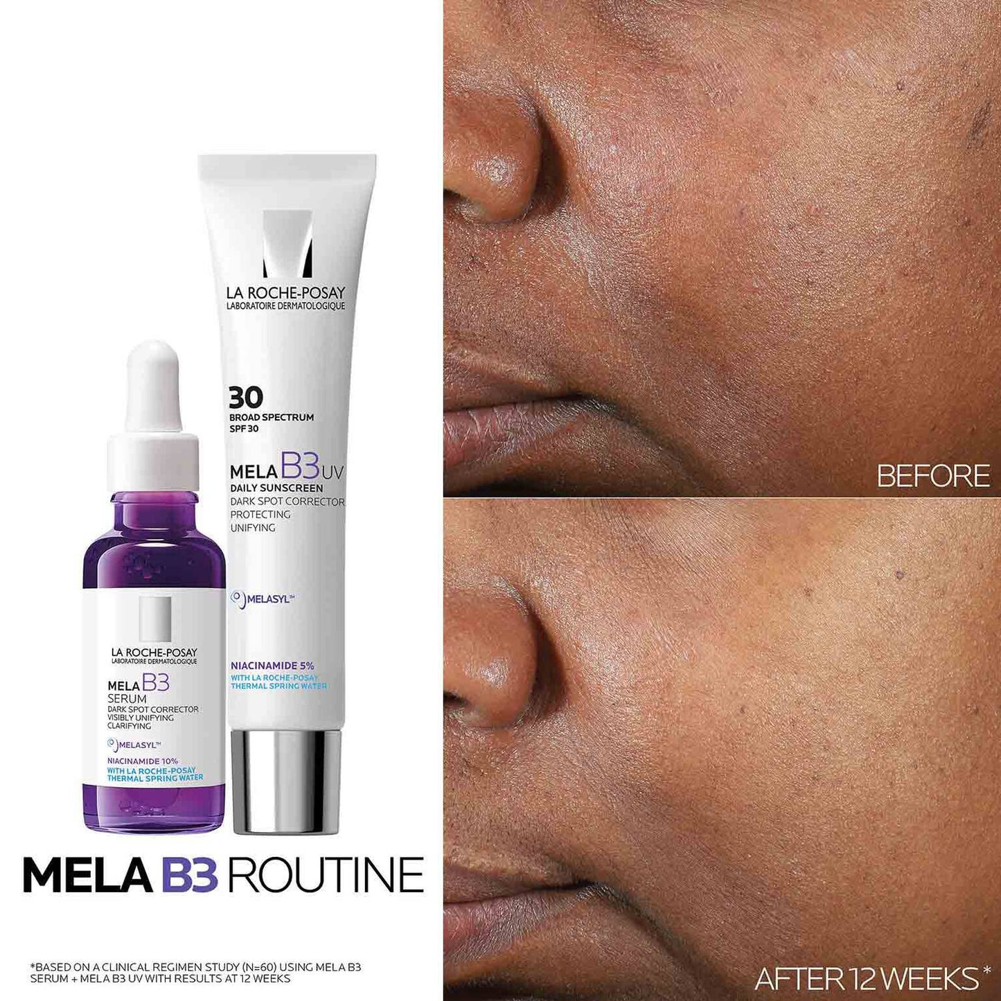 mela-b3-dark-spot-serum-with-melasyltm-niacinamide-e2 Mela-B3-routine_1500X1500.jpg