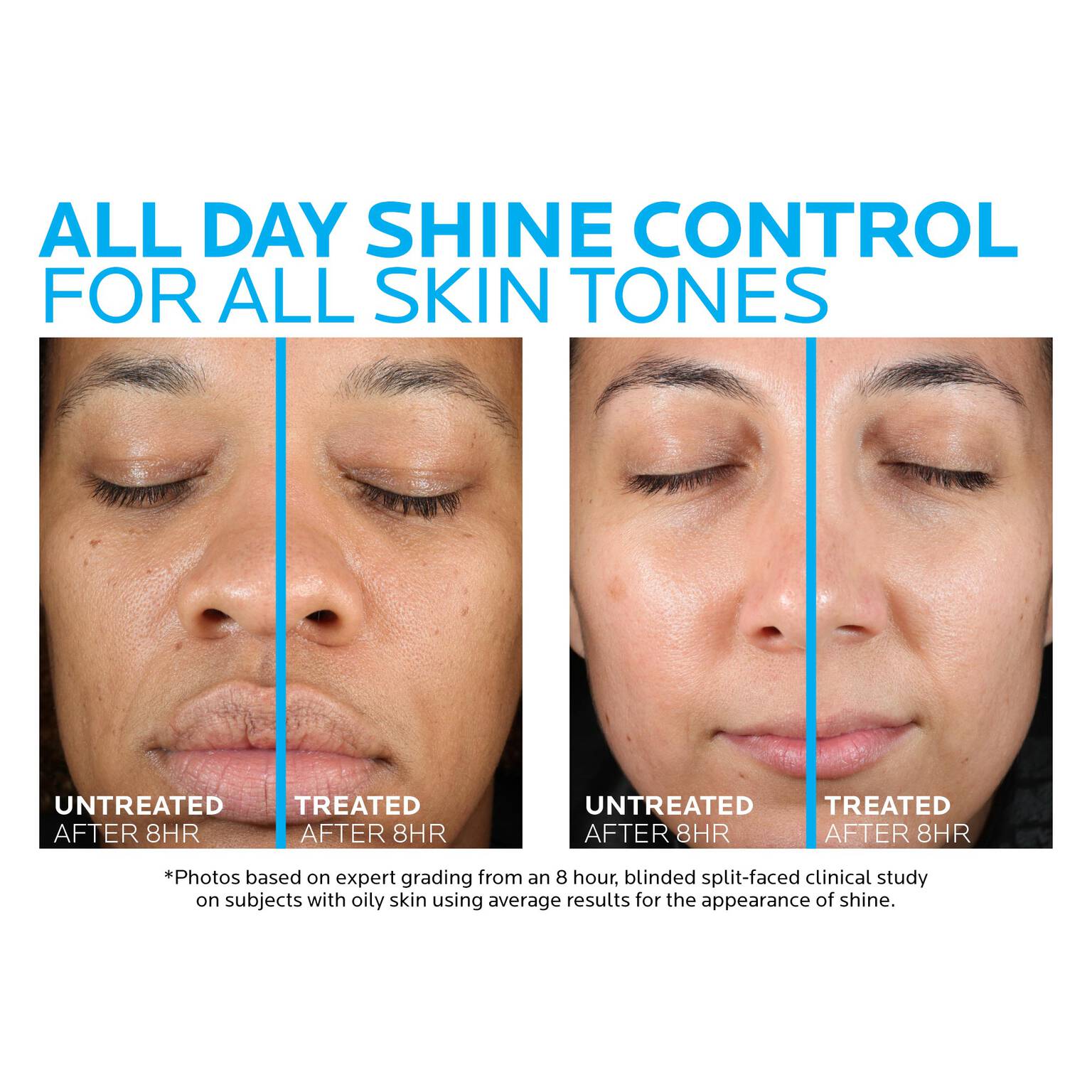 toleriane-double-repair-matte-face-moisturizer-for-oily-skin-w0 la-roche-posay-toleriane-matte-moisturizer-before-and-after-pdp-alt.jpg